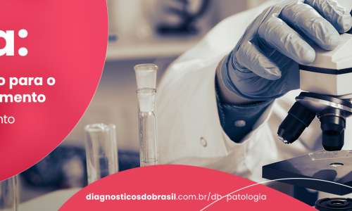 Biópsia, o começo de tudo — Como um resultado pode mudar a vida de uma pessoa